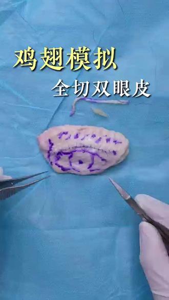 挑战用鸡翅模拟双眼皮手术,你学会了吗?#手术室日常#全切双眼皮#双眼皮手术#秦瑞雨双眼皮