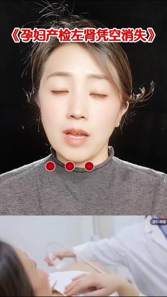 孕妇产检左肾凭空消失~#社会百态 #孕妇 #万万想不到 @DOU+小助手 #谜案