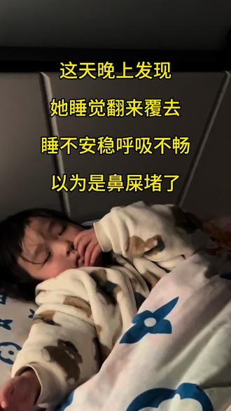 姐妹们看孩子有点费妈呀!如果不仔细可能就发现不了,不知道这小玩意塞了多久,拿出来的时候鼻子已经有点粘连了,还有点感染,医生给开了药#这是个真实的事情 #育儿知识 #育儿经验 #鼻子塞异物