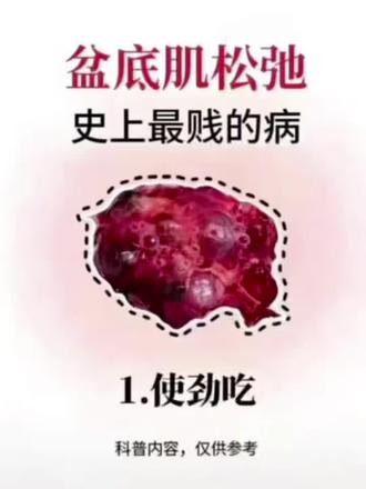 重度盆底肌松弛,记住这些就够了#盆底肌松弛#盆底肌修复#产后松弛#产后漏尿#腹直肌分离