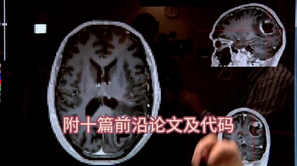 多尺度特征融合 Transformer 搭建图像检测网络,增强浅层细粒度纹理提取,有效提升复杂场景微小目标定位与识别精度。#Transformer #图像处理 #目标检测 #计算机视觉 #深度学习