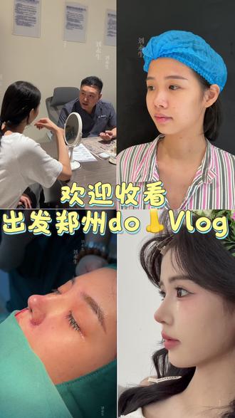 毕业后姑娘出发到郑州美👃真实详细的vlog #vlog日常 #do鼻 #微起伏 #做鼻子恢复期 #刘一刀