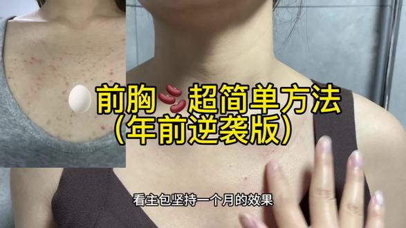 低成本🥚前胸痘小技巧,有问必答!!#前胸后背痘 #前胸后背长痘痘 #前胸后背起了很多红疙瘩 #vlog十亿流量扶持计划 #护肤分享
