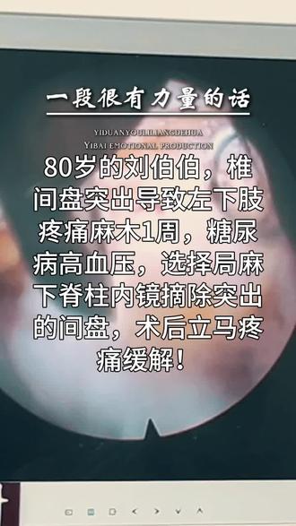 筋骨之疾,藏于偏隅便易被疏漏! 半年前,孙子的腰疾内镜相助,摆脱病痛。如今旧他们全家坚定选择信任我们。
如今刘伯伯腰45骶1巨大突出,内镜之下巧除病灶。疼痛转瞬远去,一夜酣然入梦。
以匠心辨隐疾,以仁心守安康,不负每一份远道而来的期许✨