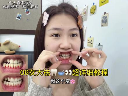 06女大去🦷🥣👀最屌的法子(详细教程版)
#牙周火火#黑三角#牙齿护理#牙齦萎縮#百亿流量扶持计划