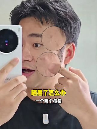碧绽美花椒乳经典版清爽型15g中样试用华西专利晒后薄涂厚涂修护#霍尔果斯智慧云谷人力资源产业园管理有限公司 #东莞市盛鼎精密科技有限公司 #万顺液化气站 #贵港市桦宇单板厂