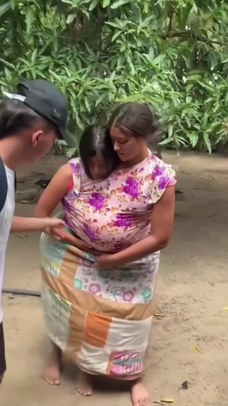 #分享国外视频 连体姐妹怀孕了