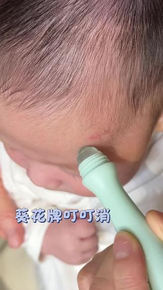 宝妈们,听我一句劝,夏天到了叮叮消一定要备在身上!#葵花牌叮叮消 #止痒消包 #母婴好物推荐 #夏日宝宝必备单品