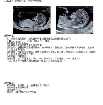 看看是准备👖还是👗#孕期检查 #nt检查