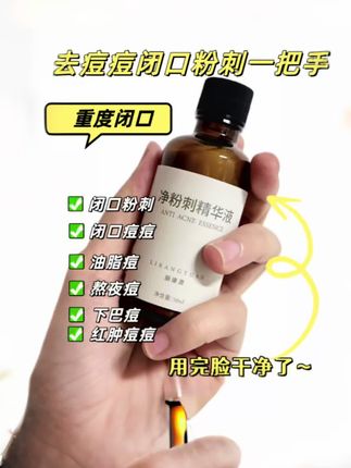 去除闭口粉刺的救星来了,简直超出我预料的好 #逆袭 #变美 #痘痘肌 #闭口粉刺 #闭口
