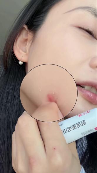 主包终于悟了什么是剥了壳的鸡蛋🥚#三角洲 #痘痘 #重组胶原蛋白 #三角洲行动