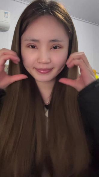 第一次拍点紧张 剪得也不好谢谢大家包容,希望我说的这些多大家有些帮助#双眼皮恢复记录 #真实vlog日常vlog #双眼皮手术 #日常分享