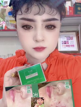 娣丽日桠祛痘霜مايلىق سىەزگۈر گادا تىرە ئىشلىتسىز
