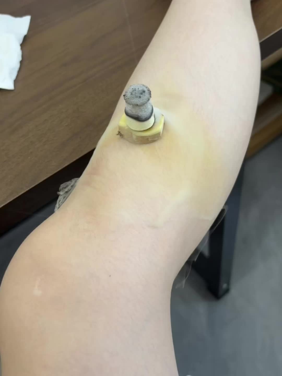 为什么要做艾灸❓ 为什么要做艾灸❓ 现代人贪食寒凉、工作疲劳 非时作息、性情浮躁都在耗损着阳气 而人体脏腑的运转,经络的运行等 一切生理活动都离不开阳气的推动 中医养生保健重在扶阳 而最直接有效补充阳气的方法就是艾灸👌 #滋补养生材料 #喝苹果山楂水红枣水上火吗 #艾灸养生保健 #气虚和气血不足有区别吗