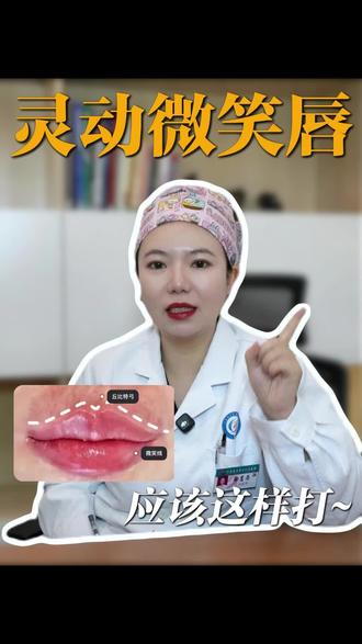 唇珠不明显?0.5ml打造微笑唇
#注射唇 #玻尿酸 #唇珠#微笑唇 #郑州注射医生