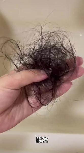 内调真的有用#鲁舒堂阿胶红参膏#掉发