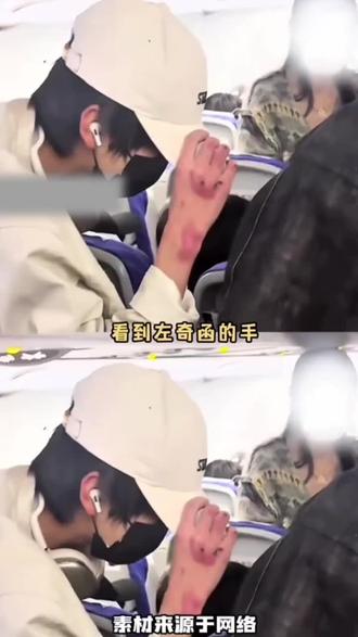 他先护住了他的头……#左奇函#架子鼓鼓手#受伤