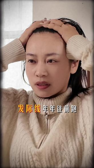 发际线年年往后跑,到底该怎么办?一个小方法帮你解决烦恼!!!#发际线 #石墨烯 #远红外光 #脂溢性 #产后