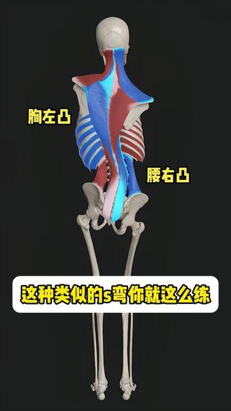腰右凸胸左凸,s弯你就这样练#体态纠正 #脊柱侧弯 #脊柱侧弯矫正 #青少年脊柱侧弯 #体态矫正