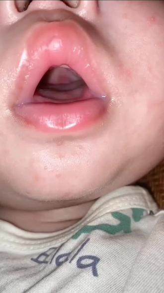宝宝吸吮时舌头呈波浪状,好神奇的小舌头~长大这种技能就消失了……