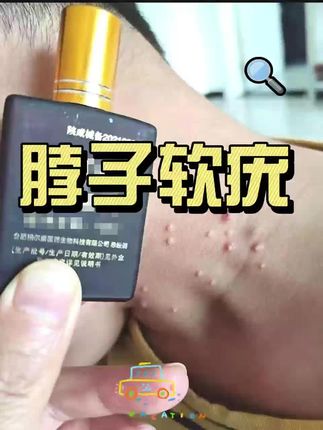 脖子背上小疙瘩,去除有妙招。#软疣 #扁平疣 #跖疣 #hpv转阴 #热门新闻