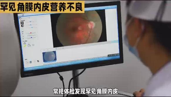 角膜内皮营养不良#医学科普健康