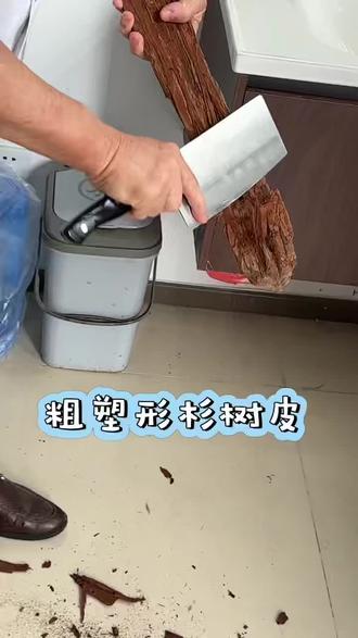 小夹板固定,传统的骨折外固定方法#纯手法
小夹板固定是一种用于治疗四肢长骨骨折的外固定方法。它不同于西医管型石膏将整个肢体完全包裹,其核心原理在于 “动静结合”、“弹性固定” ,巧妙地运用了生物力学和生理学知识。1️⃣功能恢复快,后遗症少(核心优势)2️⃣骨折愈合质量高3️⃣便于观察与调整,安全系数高4️⃣并发症风险低,患者舒适度高5️⃣ 经济实惠,治疗成本低 总而言之,小夹板固定的优势在于它不仅仅是一个“固定”工具,更是一个符合骨骼生物力学和生理愈合规律的、动态的治疗系统。它以功能恢复为导向,在有效固定的前提下,最大限度地调动和利用了人体自身的修复与调节能力,实现了“治疗与康复同步进行”的理想效果。当然,其成功应用高度依赖于医生的正确操作和患者的密切配合与定期复查。