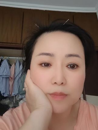 在家里针灸#足不出户