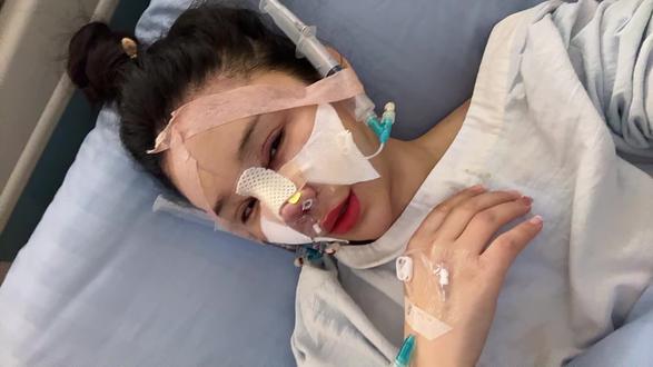 以后我流的每一滴眼泪都要划过我的高鼻梁👃 #肋骨鼻👃修复#全麻do鼻后的反应