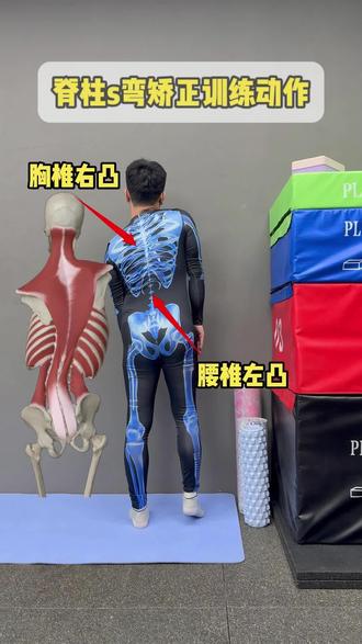 腰椎左凸胸椎右凸,s弯你就按照这样练#体态纠正 #脊柱侧弯 #脊柱侧弯矫正 #青少年脊柱侧弯 #体态矫正