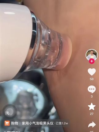 吸黑头仪