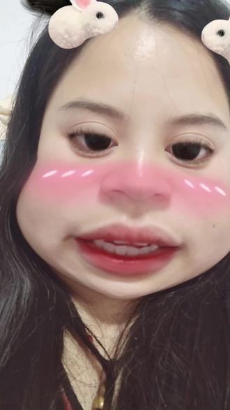 嗓子依旧很疼 还是浑身酸痛 医生说多喝水 我这个症状是提高新陈代谢造成的乳酸堆积 多喝水会好点#替尔泊肽减肥