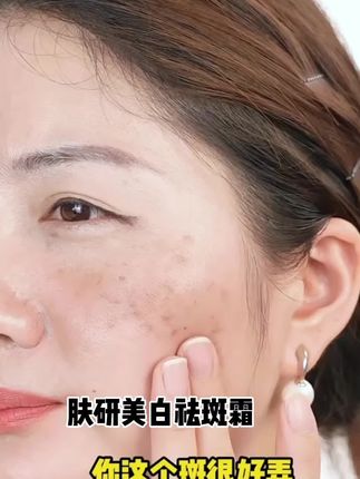 #好物推荐🔥 姐妹们如果你脸上长了各种斑点,真的不用再烦恼了,快来试试这个国妆特字肤研美白祛斑霜吧!它含有高浓度的烟酰胺精华,可以有效淡化各类色斑,还能提亮你的肤色哦。而且它是男女通用的哟!现在下单拍一发三