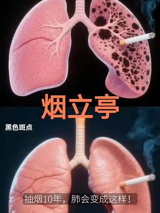 #戒烟就用烟立亭#内容仅供参考,如有不适请线下就医