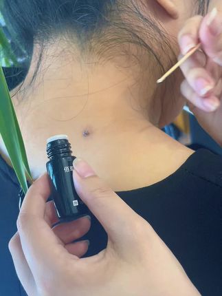 #好物推荐🔥 #一起变好看 #变美小技巧 #脖子上的小肉粒 #腋下丝状疣