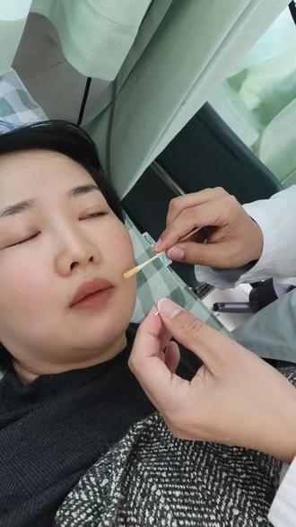 针灸了那么多地方,也就这个医生让人觉得很暖,像朋友一样关心人,张医生的办公室里挂满锦旗,这是有原因的,被张医生的细心,共情,温暖到了,这么体贴的人都有嫁给他的想法了🤩#针灸调理 #抖音玩法合伙人计划#创作者扶持计划#上热门#面瘫