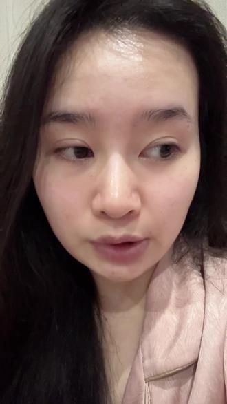 来体验抗衰项目啦没想到这个效果还蛮不错的#Onda #日常 #vlog