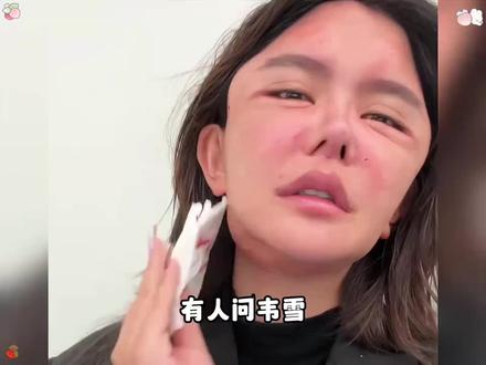 有人问韦雪,如何看待韩安冉因为过度整容导致呼吸不畅….#韦雪 #面膜 #面膜推荐 #护肤 #护肤分享