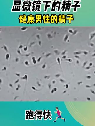 年轻小伙显微镜检查下空空如也#关爱男性