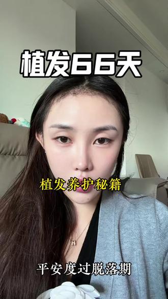 植发后护理 不到三个月脱落期已过 已经在开始长头发啦#远离掉发焦虑 #只讲干货不讲废话 #植发手术 #植发的人后来怎样了