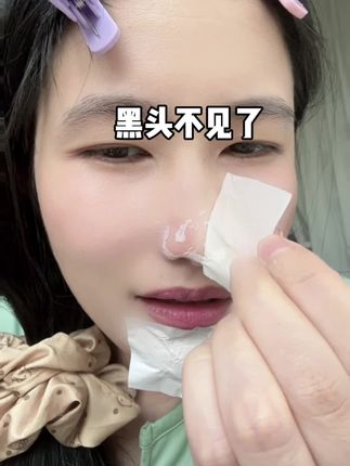 黑头粉刺闭口如何清理?#黑头粉刺 #黑头鼻贴 #护肤 #亲测分享