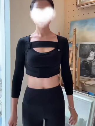 #环吸手臂 #抽脂 #手臂