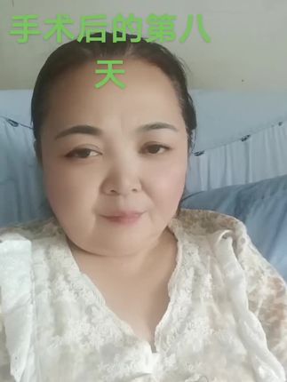 手术后的第八天!我的手术很成功!经过我的努力和锻炼!伤情一天比一天好起来!非常感谢我身边所有的亲朋好友们!对我无为不止的关心和支持!