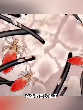 百部酊喷剂#好物分享🔥