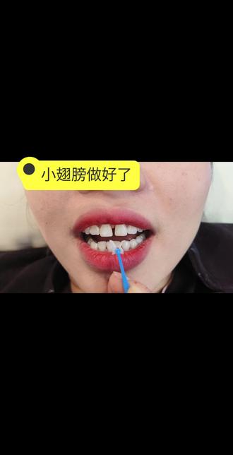 补个小翅膀,美美的过年