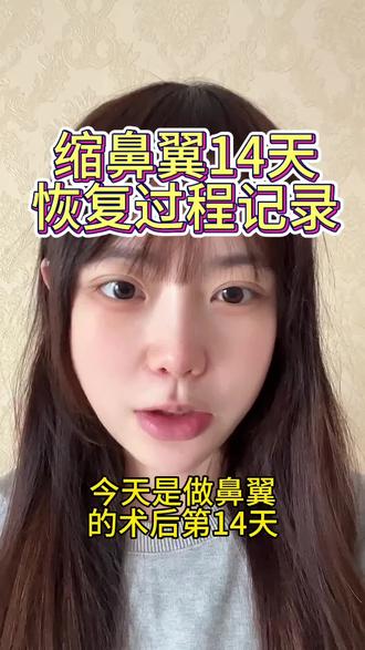 两周过的好快!#缩鼻翼#术后护理心得 #医美前后对比 #自我提升蜕变