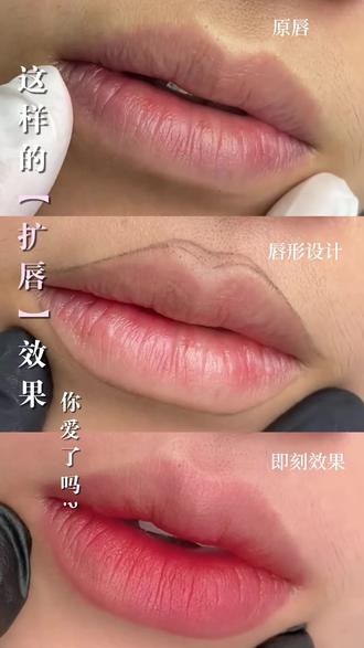 改善薄唇干瘪的同时弱化人中过长的成熟感唇峰柔和不锋利纹唇➕扩