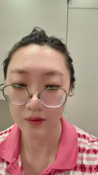 亮丙瑞林副作用 第一针第三周开始盗汗,而且越来越频繁,严重。第二针是不是就更严重了?有经验的姐妹分享一下呗。#术后恢复 #子宫内膜异位症 #亮丙瑞林 #第一针 #盗汗 @抖音小助手