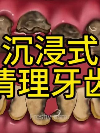 #游戏解说 #asmr场景模拟 #解压游戏 !#解压视频一起释放压力 #解压挤痘痘