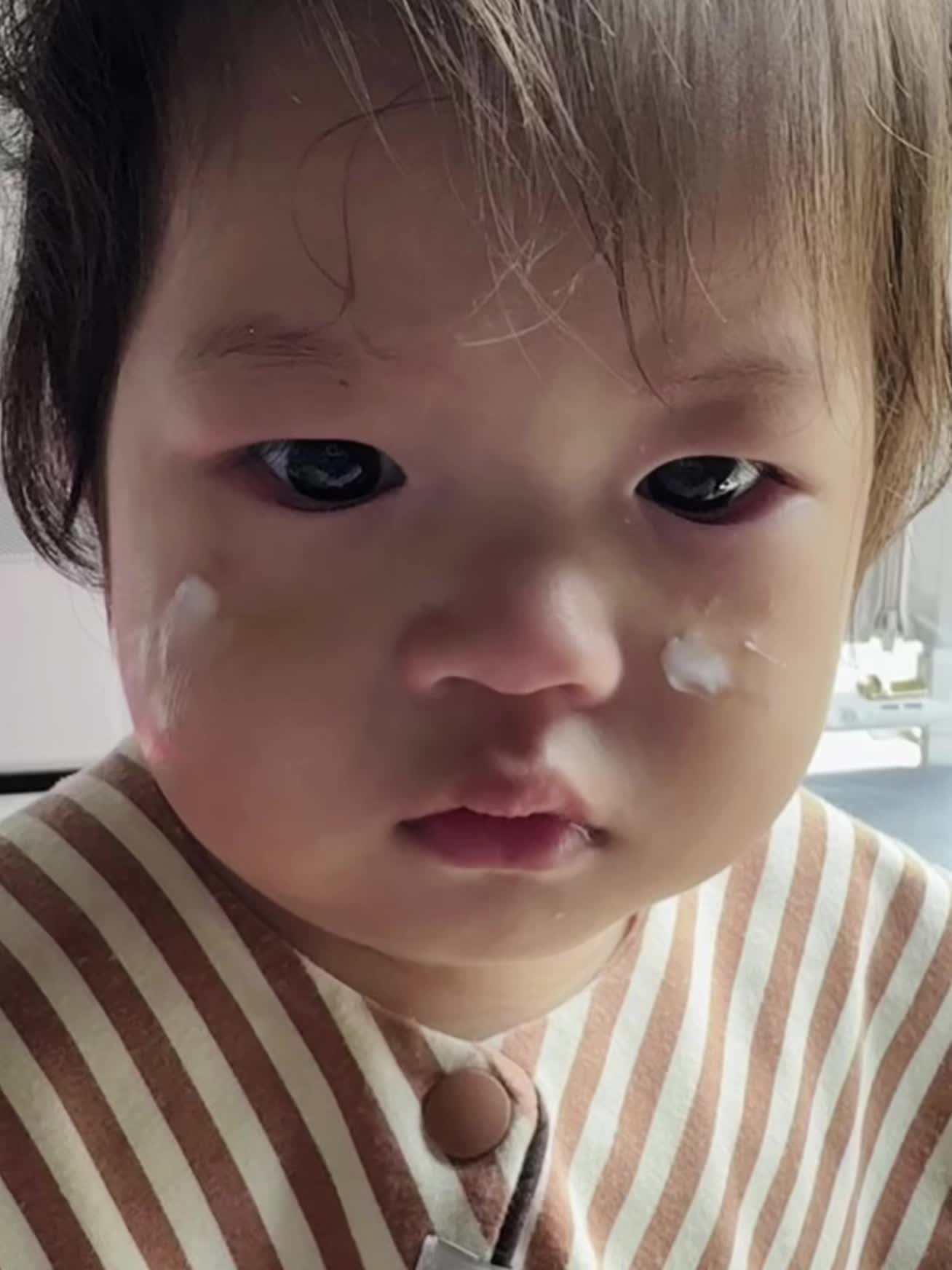 宝贝经常脸部眼睛湿疹反复 从出生到现在一周岁涂了多少药膏面霜都没见好 老母亲操碎了心 很焦虑 偶然碰到幼朴使用 用了七天 一点点在变好 皮肤也变得很光滑 很好吸收 #7天拯救换季干红敏#babycare幼朴小橙管特护霜